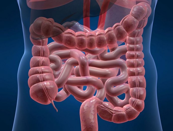 cancer colorectal