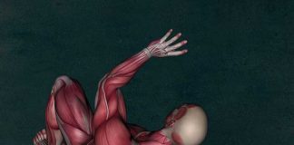 fibromyalgie
